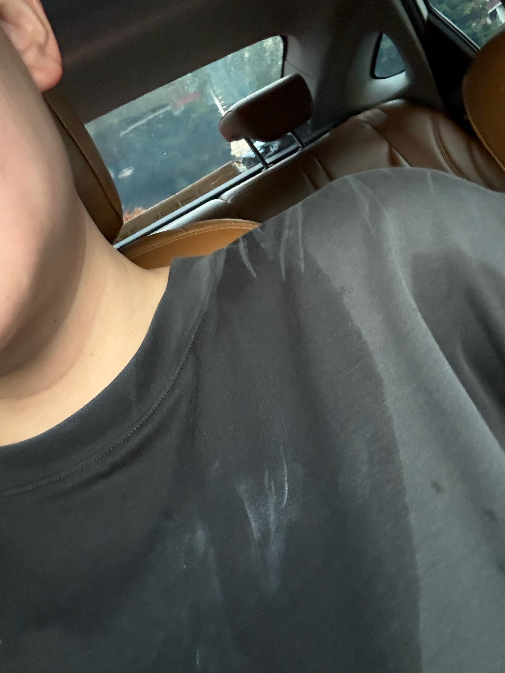 服的主要障 服的主要障